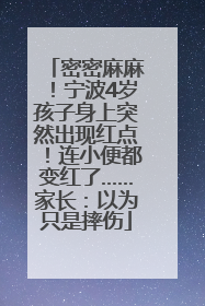 密密麻麻！宁波4岁孩子身上突然出现红点！连小便都变红了……家长：以为只是摔伤